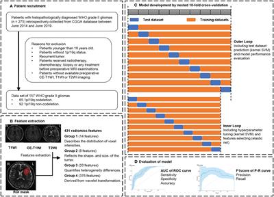 Preoperative Radiomics Analysis of 1p/19q Status in WHO Grade II Gliomas